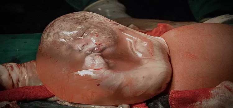 Fotógrafa de MG registra bebê empelicado em imagens incríveis; confira