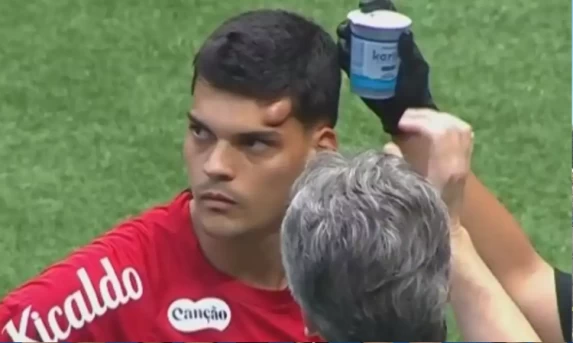 Médico da CBF diz que 'em caso de dúvida, a recomendação é retirar' após choque de goleiro do Santos
